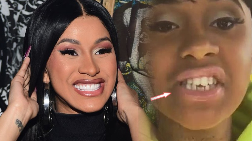 The Scary Truth About&nbsp;Veneers