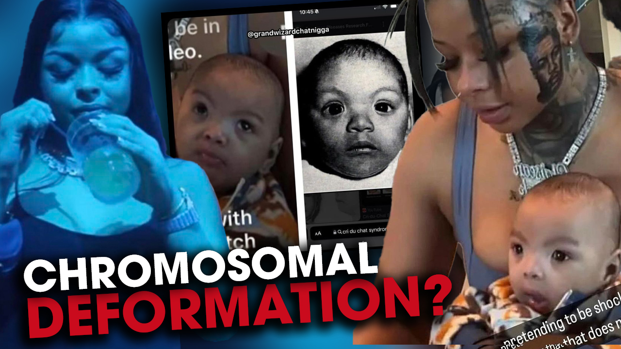 Has Chrisean Rock’s Drinking & Partying Caused Her Child To Develop A Disability?