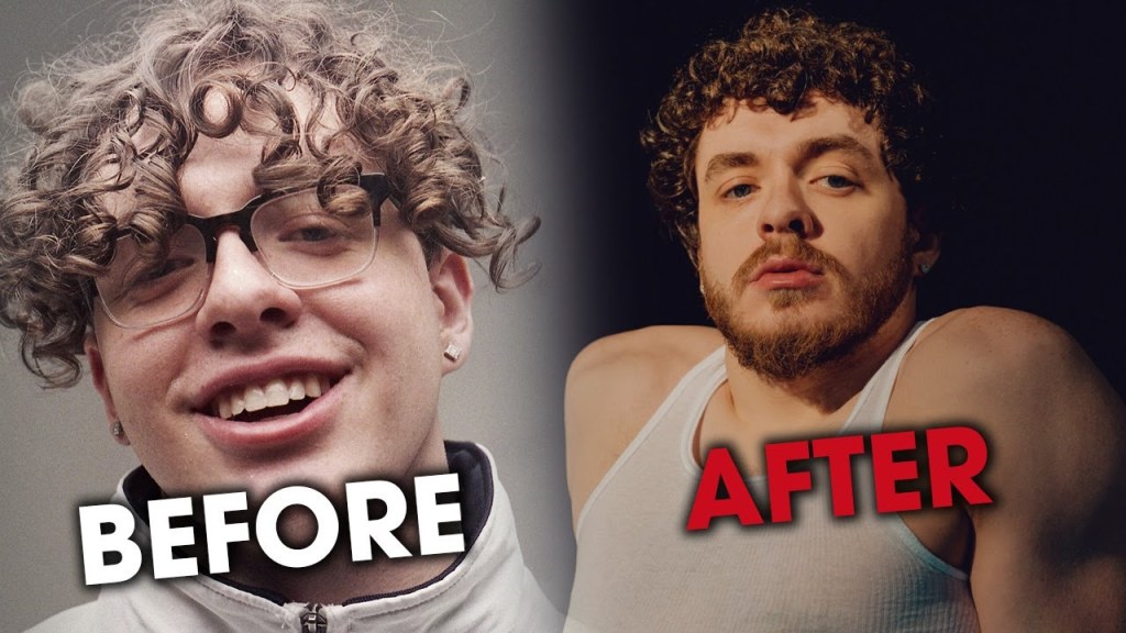Is Jack Harlow The Future Of Hip&nbsp;Hop?